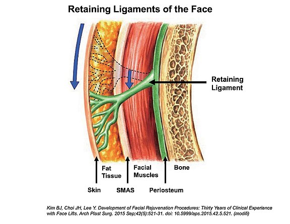 retaining bands