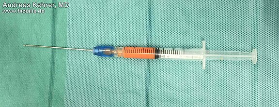 Fetttransplantation